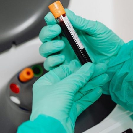 Side Effects of Anabolic Steroids: Risks, Short and Long-Term Effects