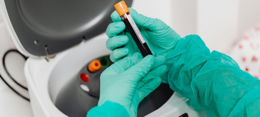 steroid side effects